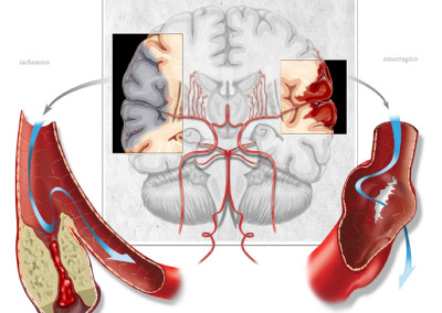 ICTUS - Digital 2008 –“Health Enciclopedia”, RCS